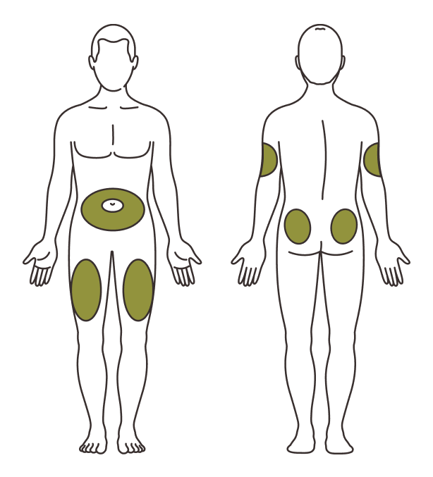 Injection sites