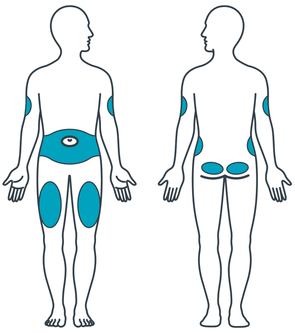 Where to inject U-500 insulin. Injection sites include the stomach area, buttocks, upper legs, and upper arms.